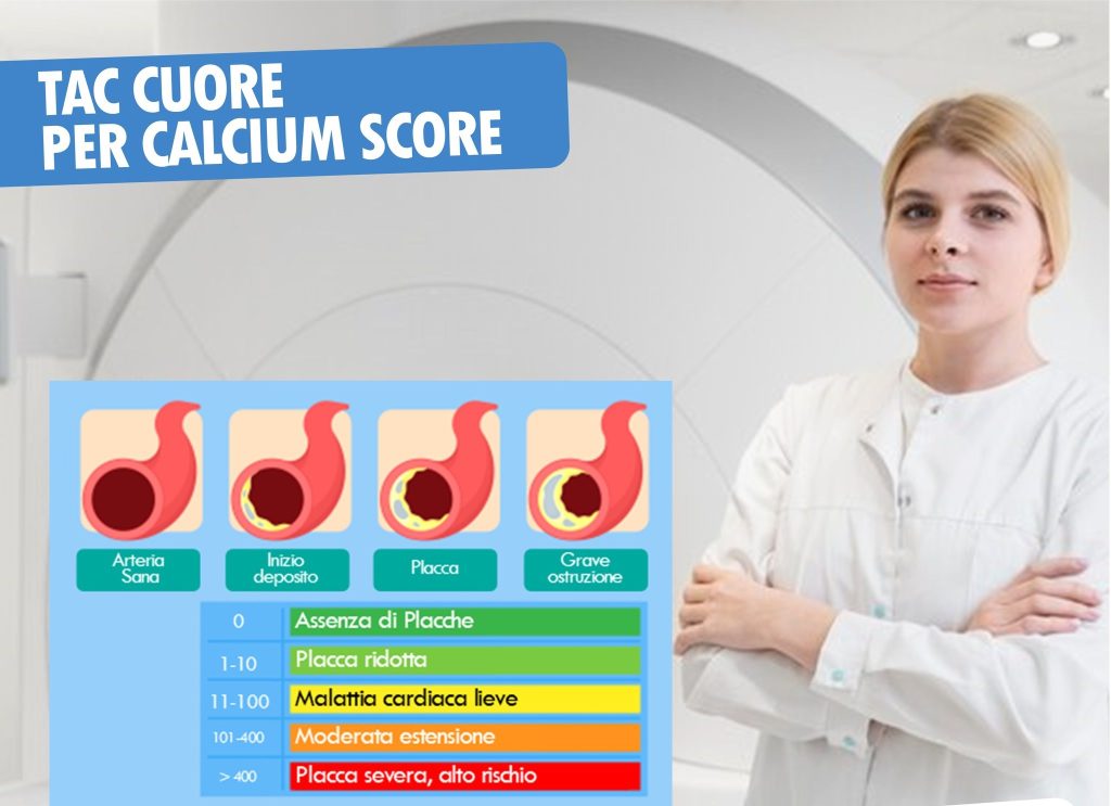 TAC Cuore per Calcium Score, un nuovo esame innovativo per la prevenzione cardiovascolare