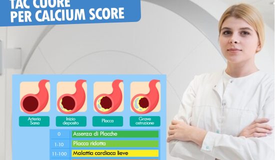 TAC Cuore per Calcium Score, un nuovo esame innovativo per la prevenzione cardiovascolare