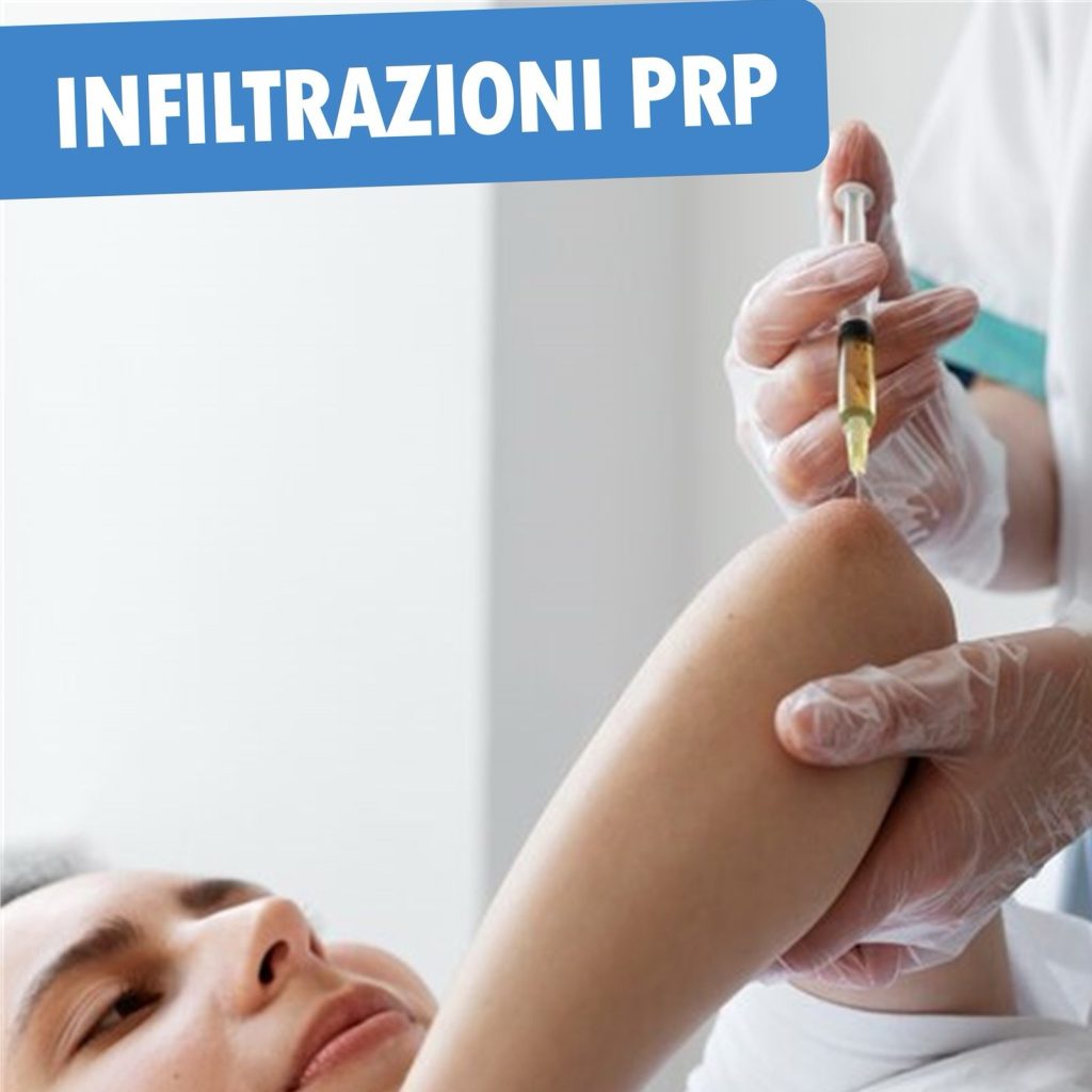 Infiltrazioni PRP: un nuovo trattamento per le lesioni muscolo-scheletriche